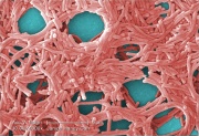 Legionella pneumophila на электросканограмме